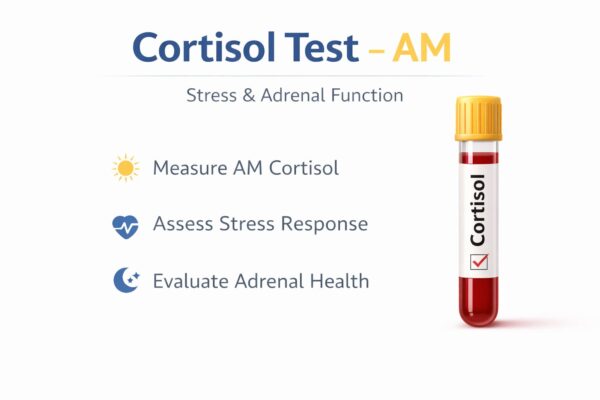 Cortisol Test - AM